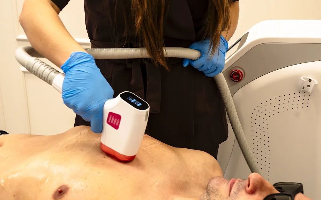 Depilacja laserowa klatki piersiowej u mężczyzny w LUMI LAB